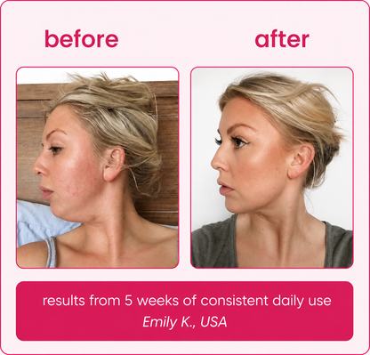 Organic Lymphatic Cutting Drops