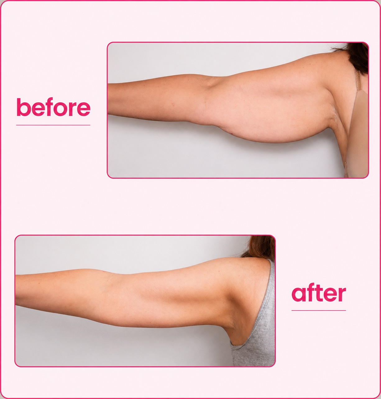 Organic Lymphatic Cutting Drops